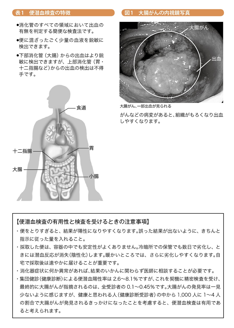 消化管からの出血の有無を判定大腸がんの発見に有用