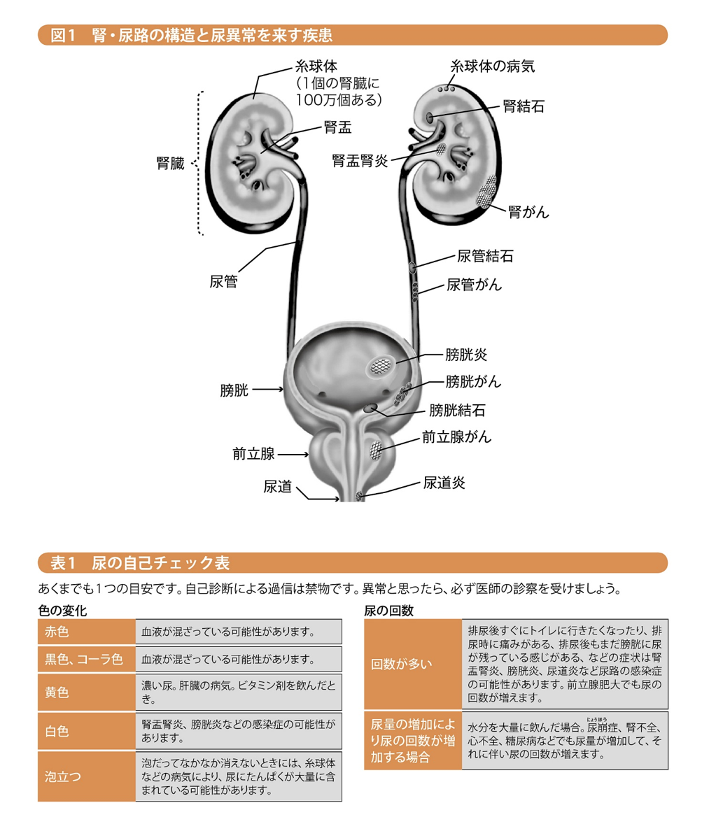 顕微鏡 的 血尿